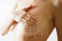 breast-implants