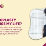How Rhinoplasty Change My Life- Mumbai Real Case