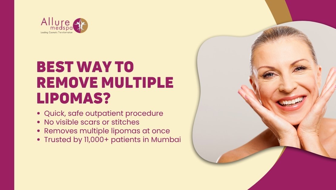 Best Way to remove multiple lipoma in Mumbai