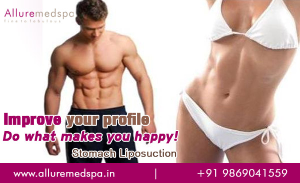 Stomach Liposuction in Mumbai, India