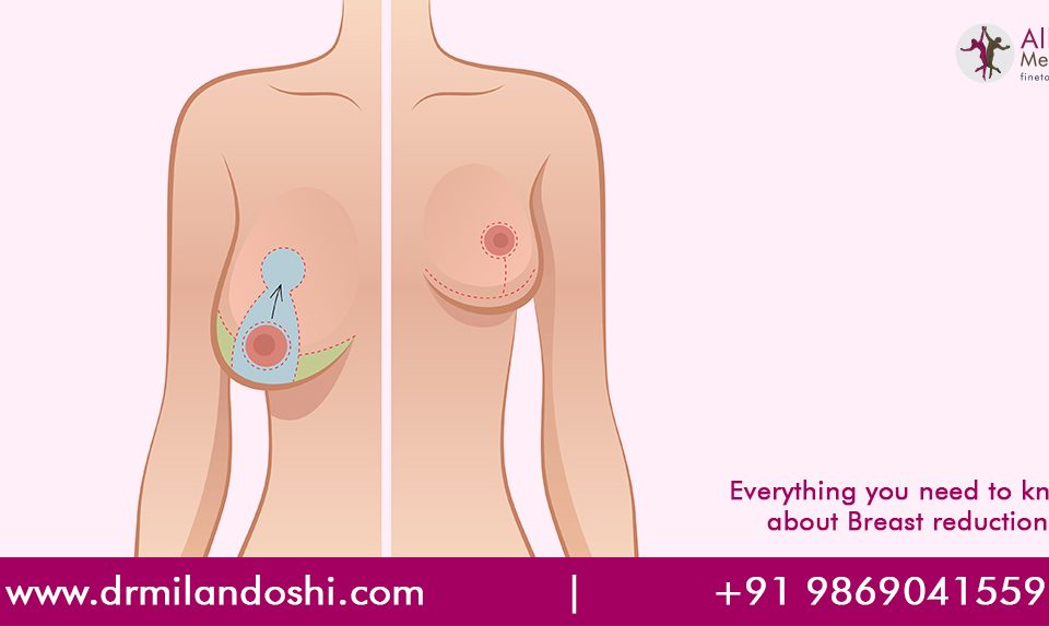 Breast Reduction Surgery in Mumbai, India