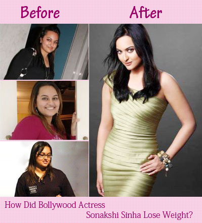 Sonakshi Sinha - Liposuction