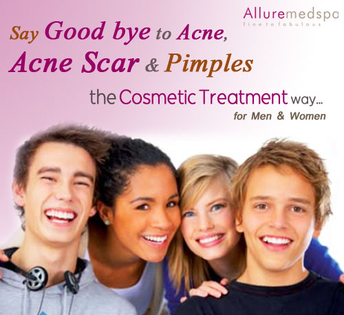 Acne and Acne Scars Removal Treatment in Mumbai,India