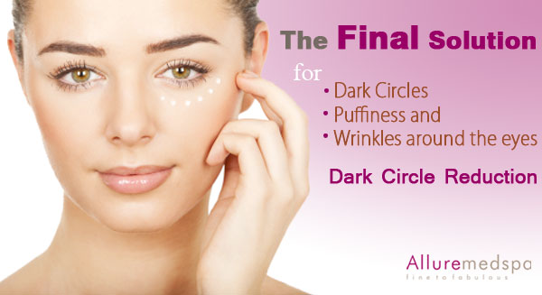 Dark Circle Removal – Best Under Eye Dark Circles Treatment