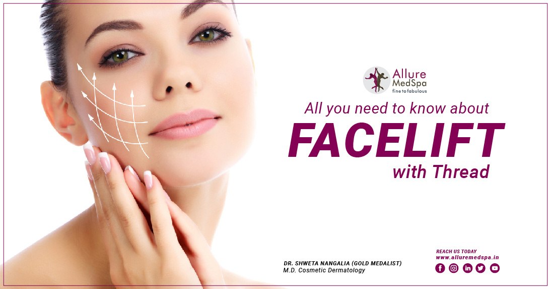 Facelift with thread