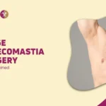 Large Gynecomastia Surgery Cost Explained in mumbai, india