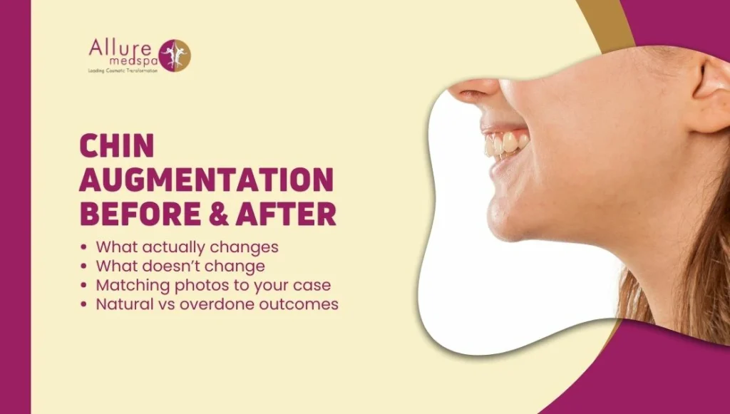 Chin Augmentation Before & After: How to Read Results (Realistic Expectations)